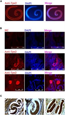 Trichinella spiralis Thioredoxin Peroxidase 2 Regulates Protective Th2 Immune Response in Mice by Directly Inducing Alternatively Activated Macrophages